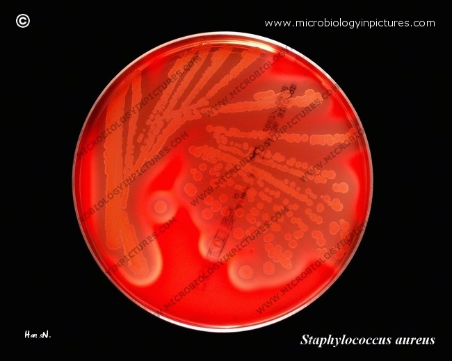 Staphylococcus Aureus On Blood Agar Plate